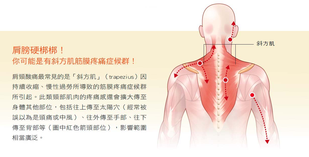 疼痛 右 肩胛骨